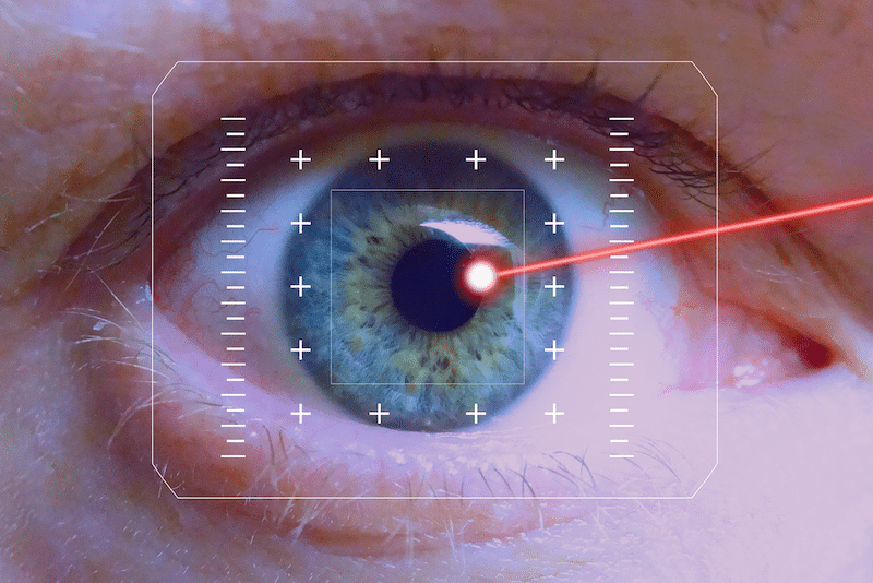 Chirurgie des yeux au laser